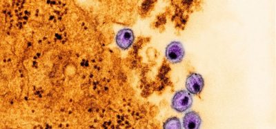 New HIV drug formulation could transform paediatric administration