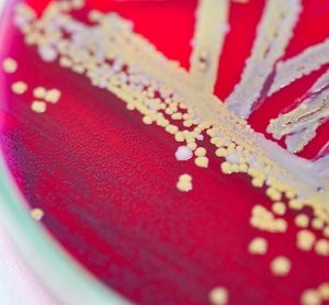 Bacterial colonies growing on culture plate medium
