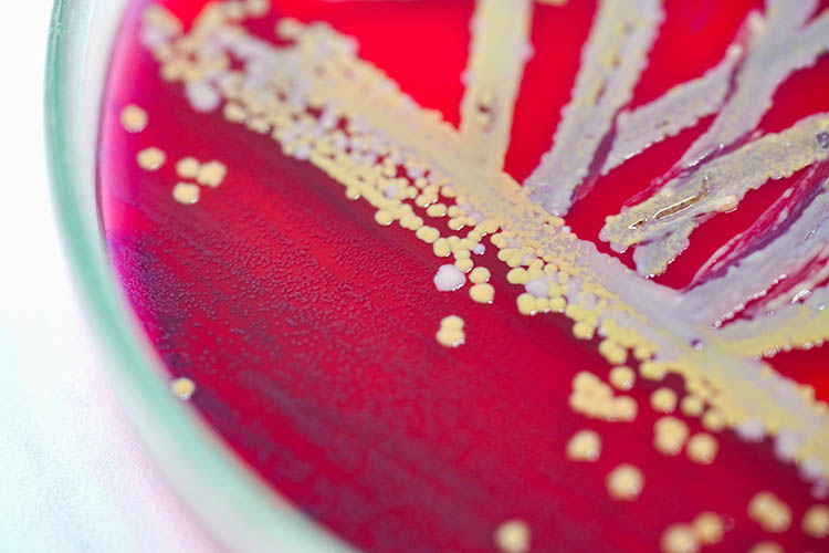 Bacterial colonies growing on culture plate medium