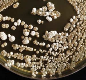 Colonies of white and yellow microbes growing in a petri dish on a black background