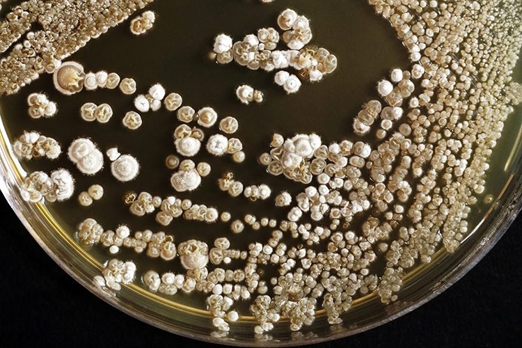 Colonies of white and yellow microbes growing in a petri dish on a black background