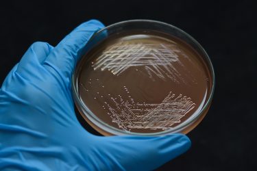 Close-up of Enterococci faecium bacterial which reddish-brown with metallic sheen colonies growth on Slanetz-Bartley (Enterococci Agar) plate with black background