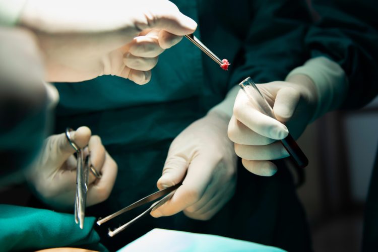 Surgeons transferring tissue sample into test tube