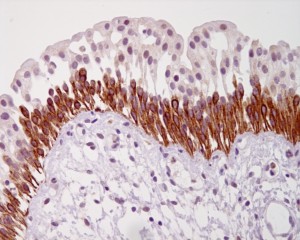 IHC image