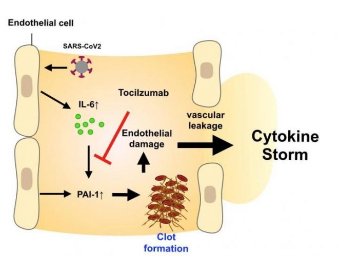 IL-6 in blood promotes thrombus formation via PAI-1. By suppressing IL-6, Actemra® reduces the severity of pneumonia caused by the cytokine storm [Credit: Osaka University].