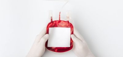 First-in-class telomerase inhibitor supports transfusion independence in IMerge Phase III trial
