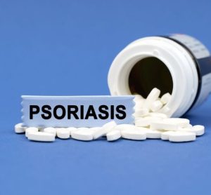 Novel oral therapy JNJ-2113 shows potential in plaque psoriasis