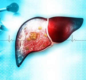 Liver with stethoscope, 3d illustration - idea of treatment of liver disease