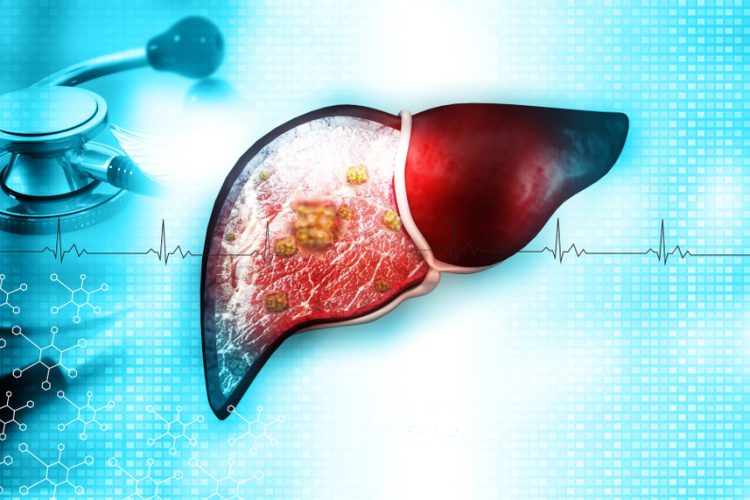 Liver with stethoscope, 3d illustration - idea of treatment of liver disease