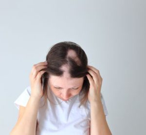 MHRA authorises Lufico alopecia treatment for those 12+