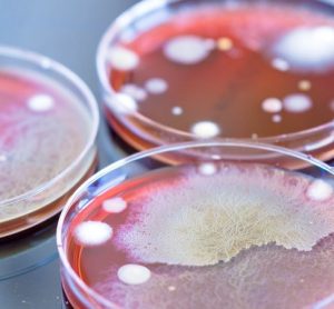 Three petri dishes with colonies of microorganisms