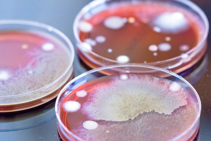 Three petri dishes with colonies of microorganisms