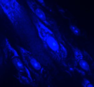 Mycoplasma contaminated cells stained with a blue dye