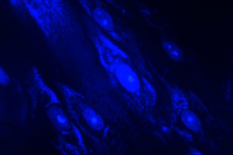 Mycoplasma contaminated cells stained with a blue dye