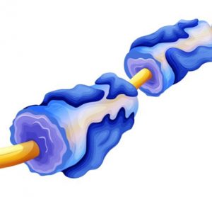 Myelin deterioration multiple sclerosis