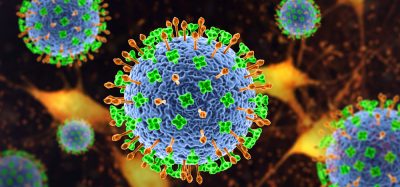 3D illustration of Nipah virus particles - Nipah virus is a newly emerging bat-borne virus that causes acute respiratory illness and severe encephalitis