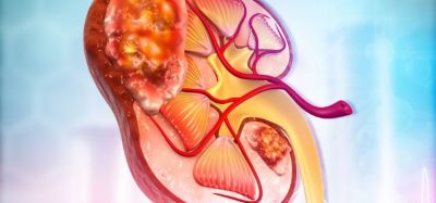 £2.5b acquisition to boost Novartis’ renal portfolio