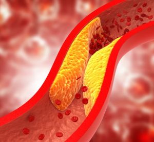 Oral PCSK9 inhibitor substantially reduces cholesterol, study finds