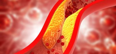 Oral PCSK9 inhibitor substantially reduces cholesterol, study finds