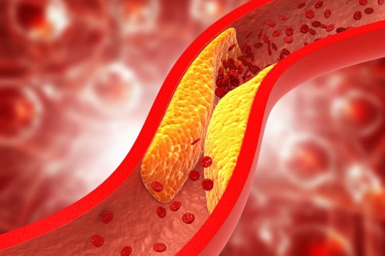 Oral PCSK9 inhibitor substantially reduces cholesterol, study finds