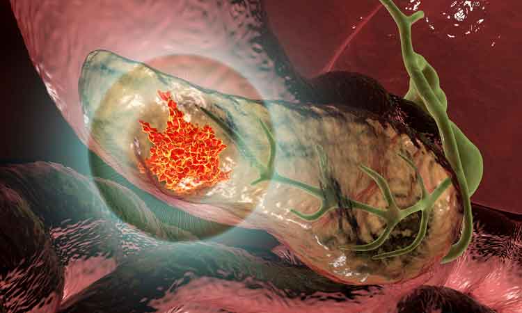 The study shows that the immune system can recognise neoantigens in pancreatic cancer, and that mRNA vaccines can be used to stimulate T cells to recognise neoantigens in pancreatic cancer patients.