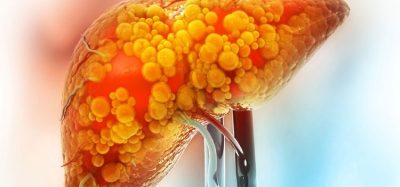 Could small molecule medicine be new long-term option in PBC?