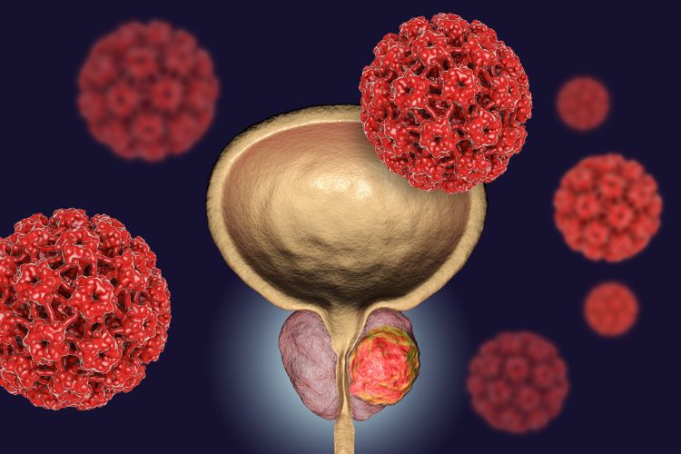 Fusion to acquire alpha-emitting radiopharmaceutical radiologand therapy for prostate cancer