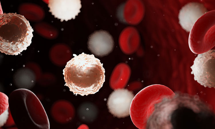 Positive results announced for acute myeloid leukaemia treatment trial