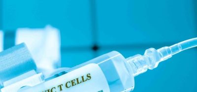 Posoleucel T-cell therapy helps overcome stem cell transplant viral infections