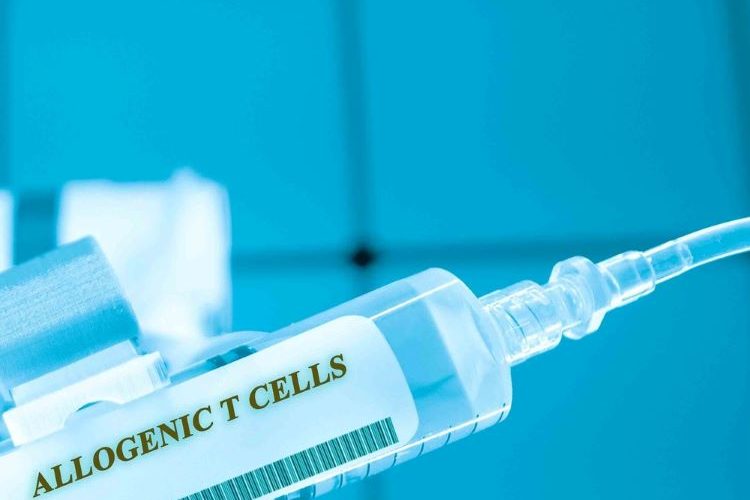 Posoleucel T-cell therapy helps overcome stem cell transplant viral infections
