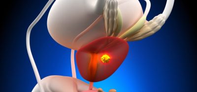prostate-cancer