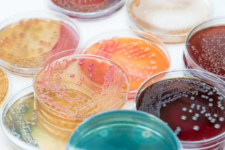 Bacterial colonies culture growth on selective media.Gram positive and gram negative growth.