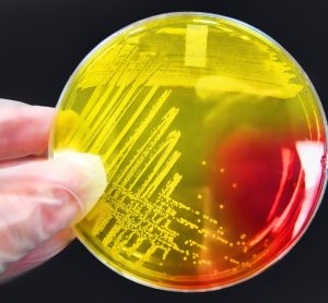 Staphylococcus aureus colony on an agar streak plate