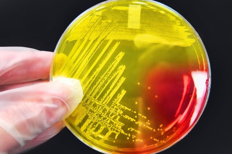 Staphylococcus aureus colony on an agar streak plate