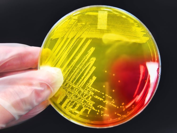 Staphylococcus aureus colony on an agar streak plate