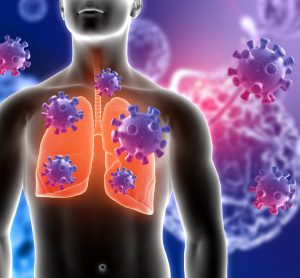 Covid-19 viral particles infecting the lungs - inhaled therapies to cure