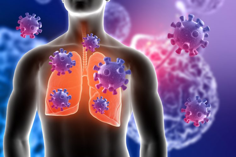 Covid-19 viral particles infecting the lungs - inhaled therapies to cure