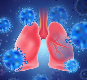 COVID-19 in the lungs