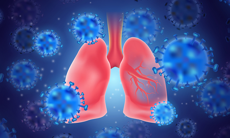 COVID-19 in the lungs