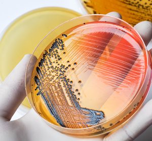 Close up of a gloved hand holding a petri dish streaked with bacteria - idea of microbiology and using AI to enhance rapid microbiological methods