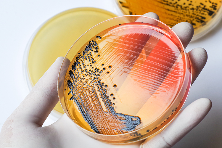 Close up of a gloved hand holding a petri dish streaked with bacteria - idea of microbiology and using AI to enhance rapid microbiological methods