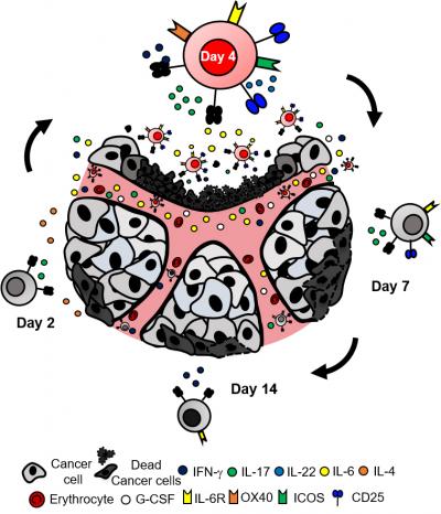 A faster approach for T-cell therapy against cancer. Knochelmann and colleagues show a subset of CD4 T-cells, Th17 cells, can effectively kill tumor cells when they are grown in cell culture for only four days. Th17 cells grown for shorter or longer periods of time cannot successfully eradicate the tumor. Additionally, the cytokine IL-6 is produced by the day-four Th17 cells, which supports the tumor-eradicating functions of the Th17 cells [Credit: MUSC Hollings Cancer Center]. 