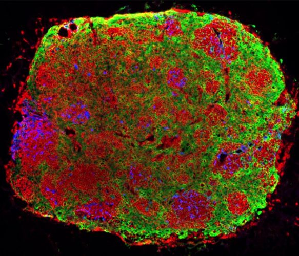 Thymic gland