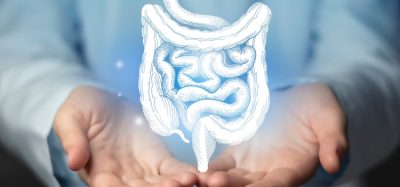 Ulcerative Colitis