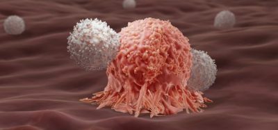CAR T therapy Yescarta exhibits encouraging proficiency in R/R LBCL