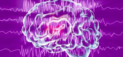 CDKL5 deficiency-associated seizure treatment ZTALMY approved in EU by EC