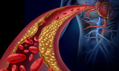 attp-blocked-blood-vessel