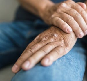 Early efficacy of arthritis therapy predicts long-term benefits