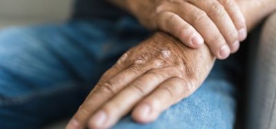 Early efficacy of arthritis therapy predicts long-term benefits
