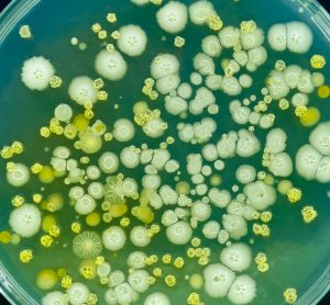 bacteria colonies of different shapes in yellow and white growing on a petri dish